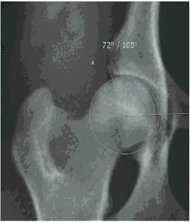 Sem sinais de displasia coxo-femoral
